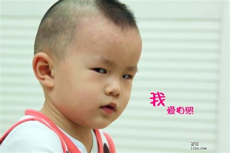 幼兒斜眼看人|斜视